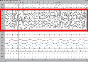 800px-Sleep_EEG_Stage_4